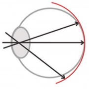 imagen_Korrigiertes-myosight