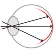 imagen_Korrigiertes_glas-myosight