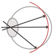 imagen_Unkorrigiertes-myosight